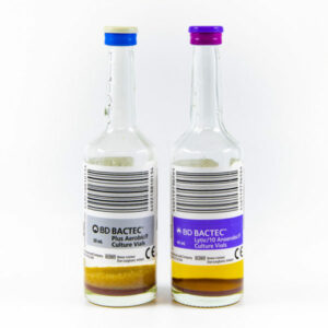 Blood Culture Anaerobic Child